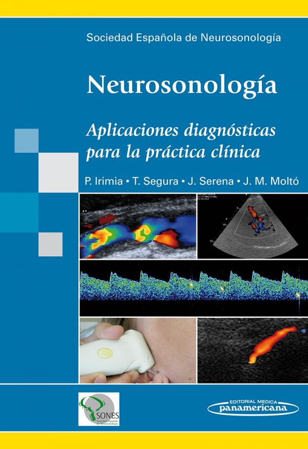 EBOOK-NEUROSONOLOGIA.APLICACIONES DIAGNOSTICAS PARA LA PRACTICA CLINICA 9788498356267