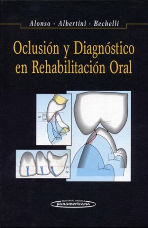 OCLUSION Y DIAGNOSTICO EN REHABILITACION ORAL