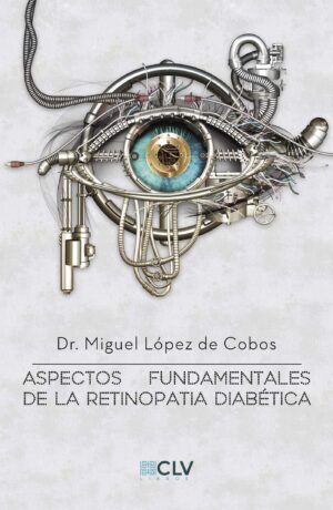 ASPECTOS FUNDAMENTALES DE LA RETINOPATIA DIABETICA