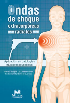 ONDAS DE CHOQUE EXTRACORPÓREAS RADIALES
