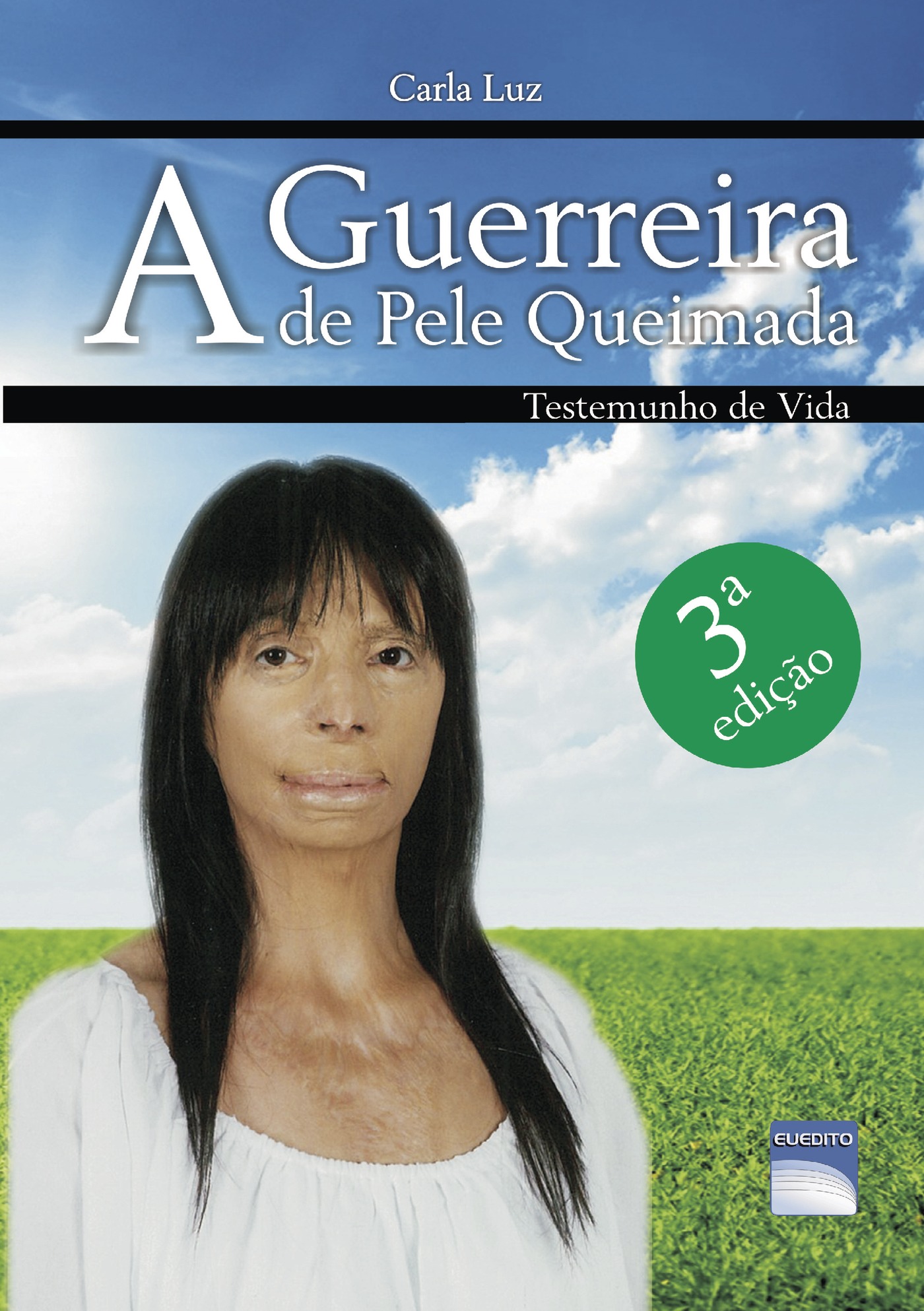 A GUERREIRA DE PELE QUEIMADA