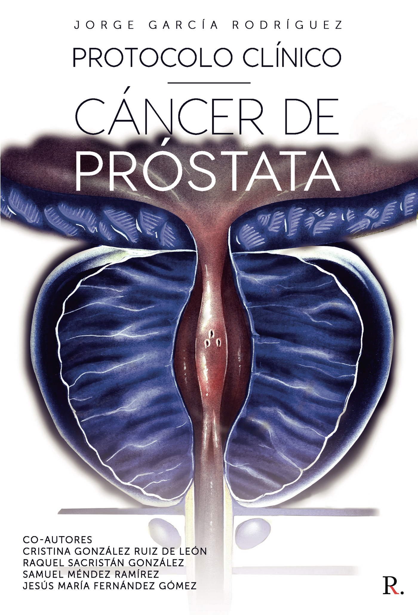 PROTOCOLO CLÍNICO CÁNCER DE PRÓSTATA