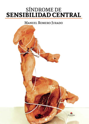 SÍNDROME DE SENSIBILIDAD CENTRAL